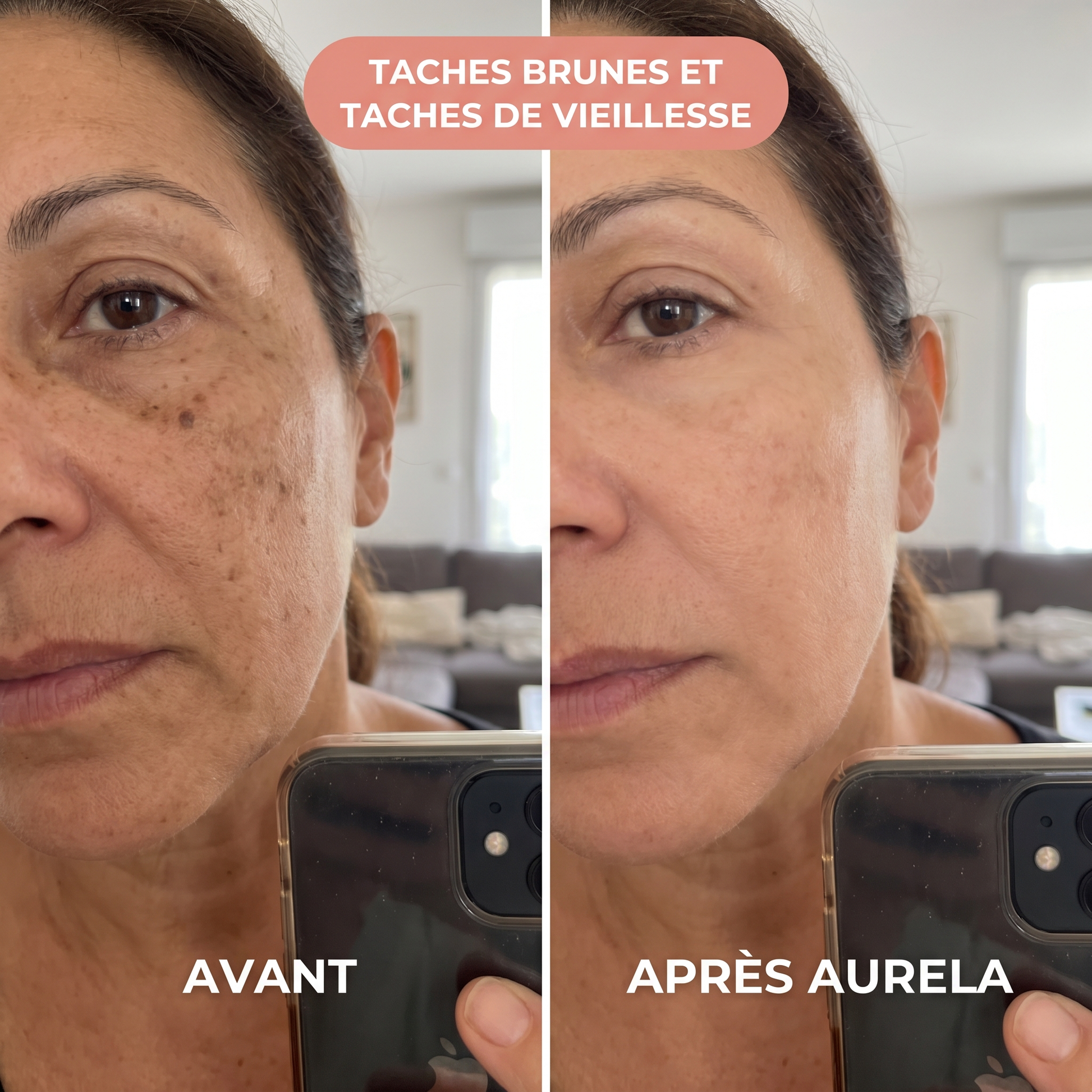 Agathe - Taches brunes - Aurela