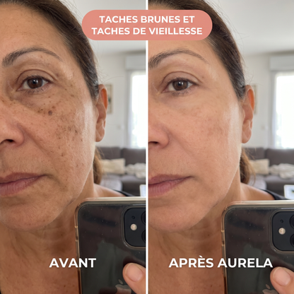 Agathe - Taches brunes - Aurela