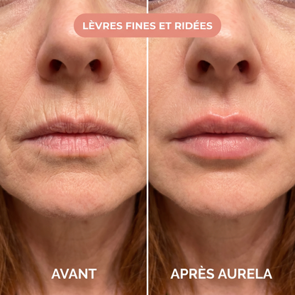 Melanie - Levres fines et ridees - Aurela