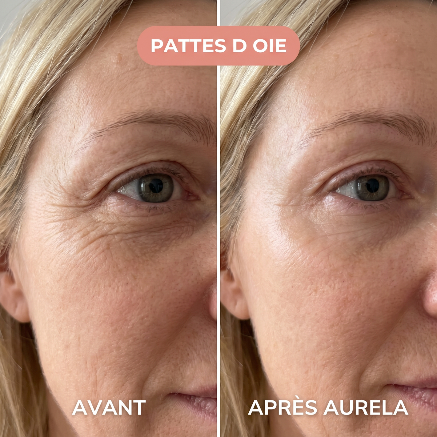Sylvie - Pattes d'oie - Aurela