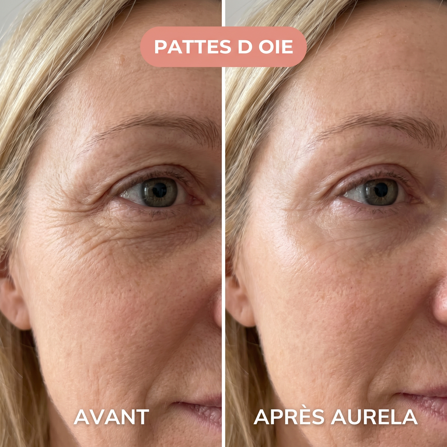 Sylvie - Pattes d'oie - Aurela