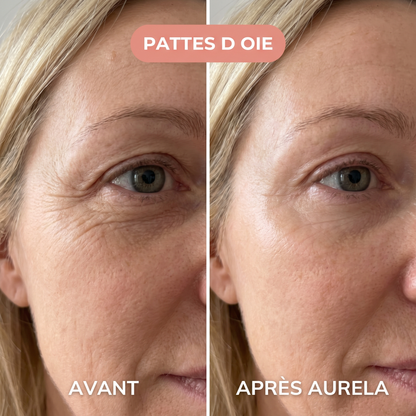 Sylvie - Pattes d'oie - Aurela
