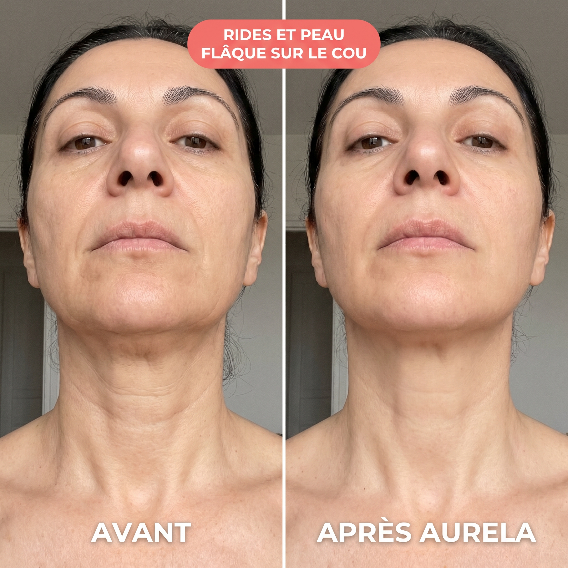 Brigitte - Cou - Aurela