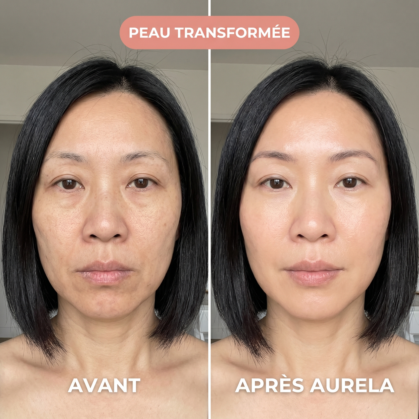 Tiphaine - Peau transformee - Aurela